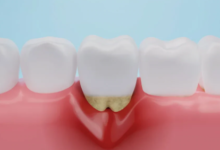 Why Collaboration Between Periodontists And General Dentists Matters