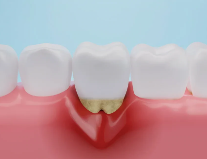 Why Collaboration Between Periodontists And General Dentists Matters