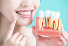 The Link Between Periodontics And Implant Success