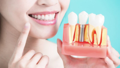 The Link Between Periodontics And Implant Success