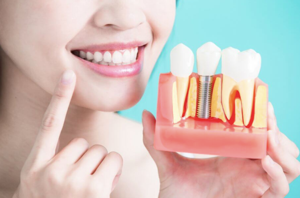 The Link Between Periodontics And Implant Success